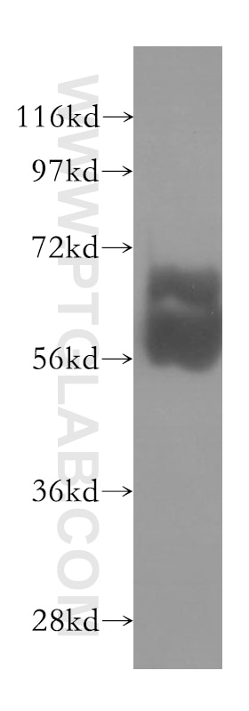 Western Blot (WB) analysis of mouse testis tissue using TBX22 Polyclonal antibody (11133-1-AP)