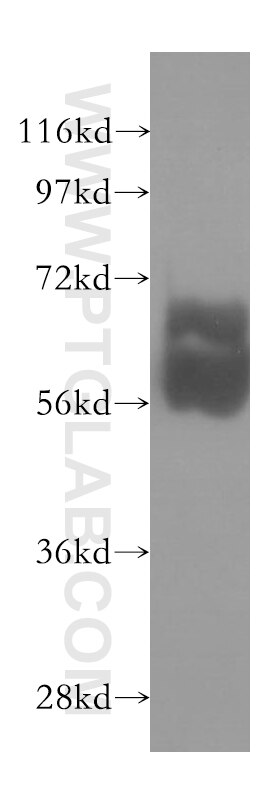 Western Blot (WB) analysis of mouse testis tissue using TBX22 Polyclonal antibody (11133-1-AP)