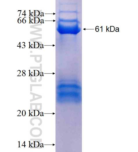 TBX22 fusion protein Ag1591 SDS-PAGE