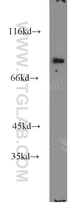 Western Blot (WB) analysis of HepG2 cells using TBX3 Polyclonal antibody (16741-1-AP)