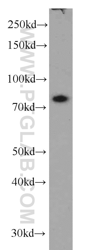 Western Blot (WB) analysis of HepG2 cells using TBX3 Polyclonal antibody (16741-1-AP)