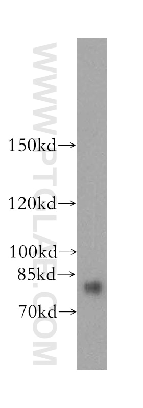 WB analysis of HepG2 using 16741-1-AP