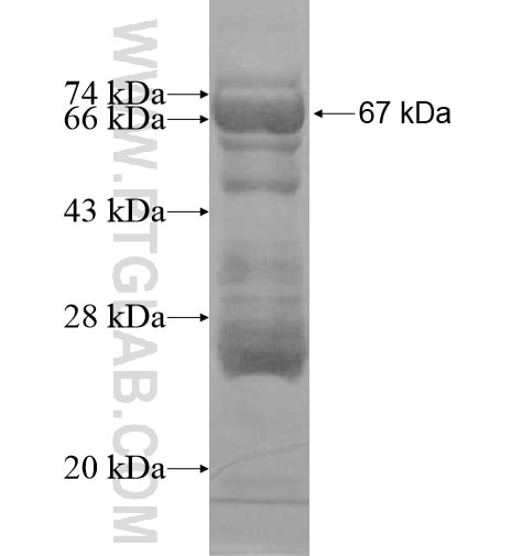 TBX3 fusion protein Ag10375 SDS-PAGE