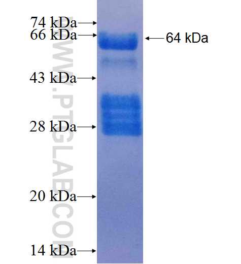 TBX3 fusion protein Ag9955 SDS-PAGE