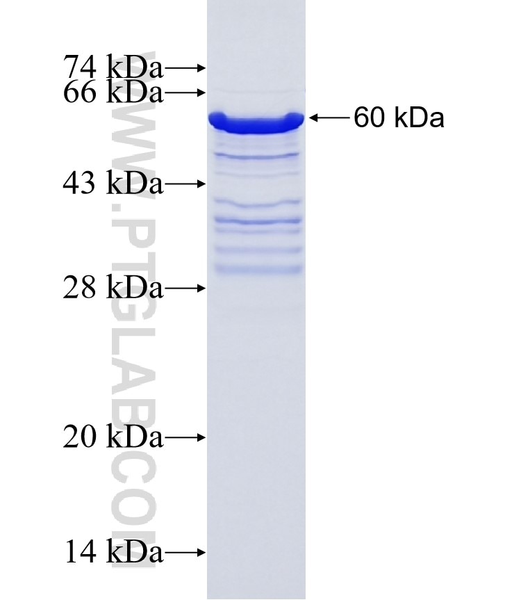 TBX3 fusion protein Ag9955 SDS-PAGE