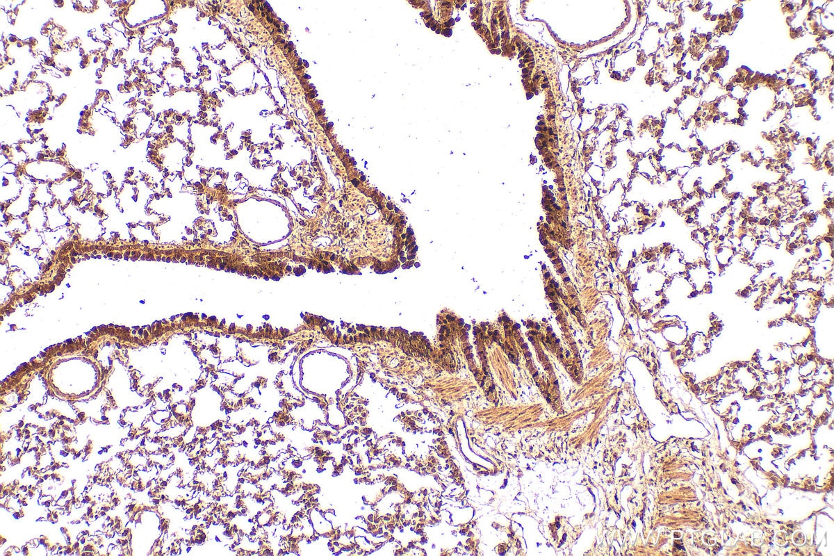 Immunohistochemistry (IHC) staining of rat lung tissue using TBX4/5 Polyclonal antibody (13178-1-AP)