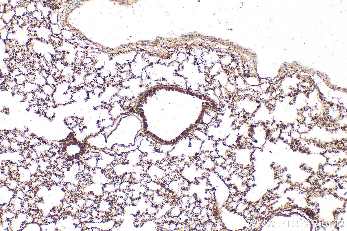 Immunohistochemistry (IHC) staining of mouse lung tissue using TBX4/5 Polyclonal antibody (13178-1-AP)