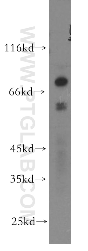 Western Blot (WB) analysis of MCF-7 cells using TBX4/5 Polyclonal antibody (13178-1-AP)
