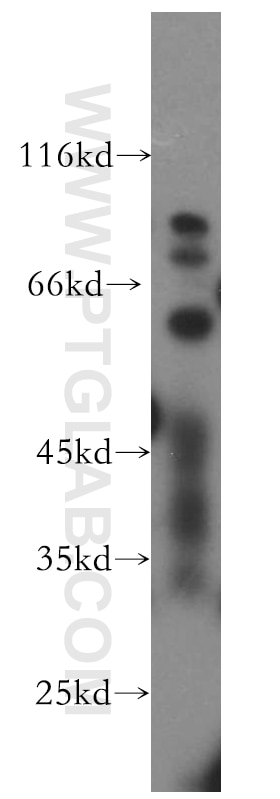 Western Blot (WB) analysis of HepG2 cells using TBX4/5 Polyclonal antibody (13178-1-AP)