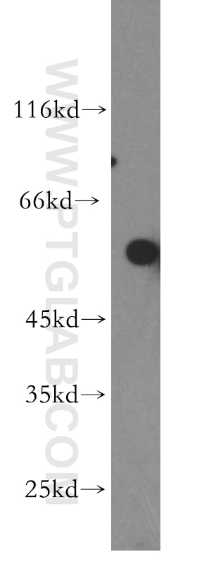 Western Blot (WB) analysis of HeLa cells using TBX4/5 Polyclonal antibody (13178-1-AP)