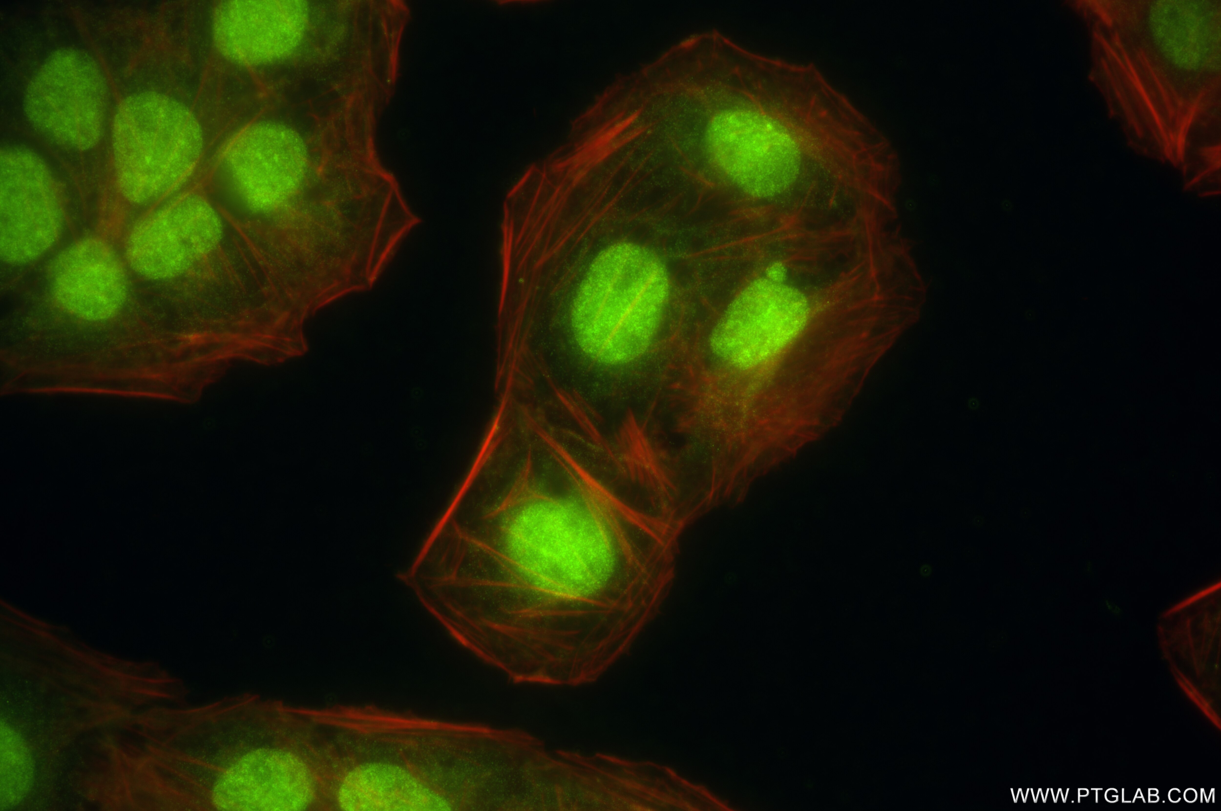 Immunofluorescence (IF) / fluorescent staining of U2OS cells using TBX4/5 Recombinant antibody (84997-4-RR)