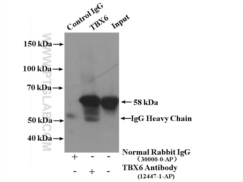 Immunoprecipitation (IP) experiment of human placenta tissue using TBX6 Polyclonal antibody (12447-1-AP)