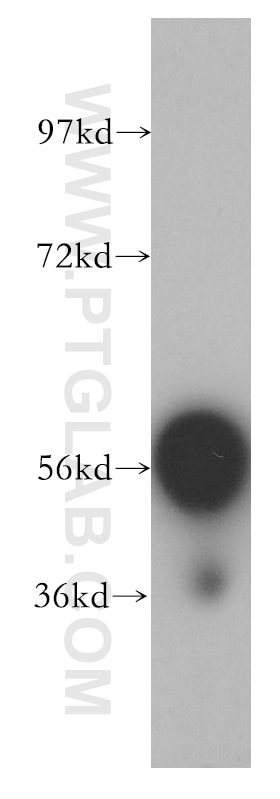 Western Blot (WB) analysis of A375 cells using TBX6 Polyclonal antibody (12447-1-AP)