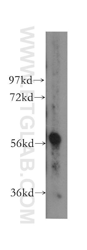 Western Blot (WB) analysis of human placenta tissue using TBX6 Polyclonal antibody (12447-1-AP)