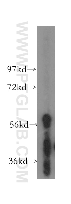 Western Blot (WB) analysis of A549 cells using TBX6 Polyclonal antibody (12447-1-AP)