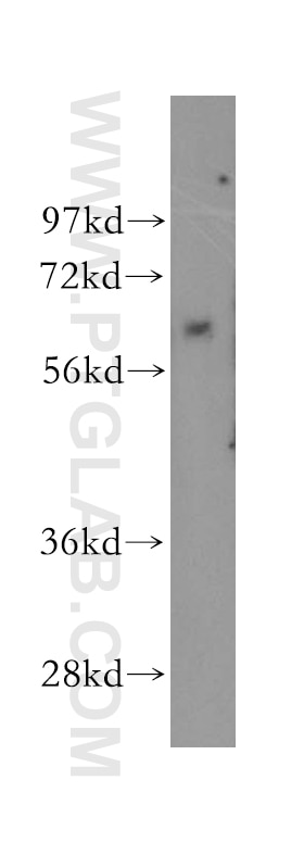 Western Blot (WB) analysis of human lung tissue using TBX6 Polyclonal antibody (12447-1-AP)