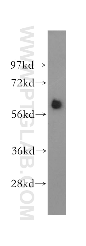 Western Blot (WB) analysis of HeLa cells using TBX6 Polyclonal antibody (12447-1-AP)