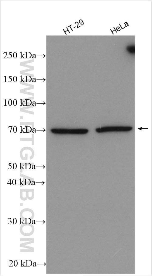 Western Blot (WB) analysis of various lysates using TBXA2R Polyclonal antibody (27159-1-AP)