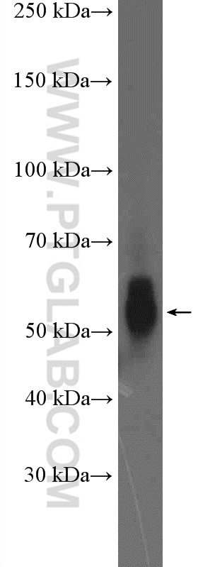 Western Blot (WB) analysis of MCF-7 cells using TBXA2R Polyclonal antibody (27159-1-AP)