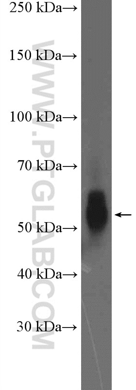 WB analysis of MCF-7 using 27159-1-AP