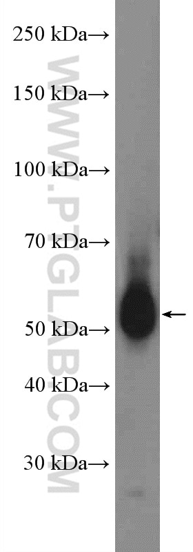 WB analysis of PC-3 using 27159-1-AP