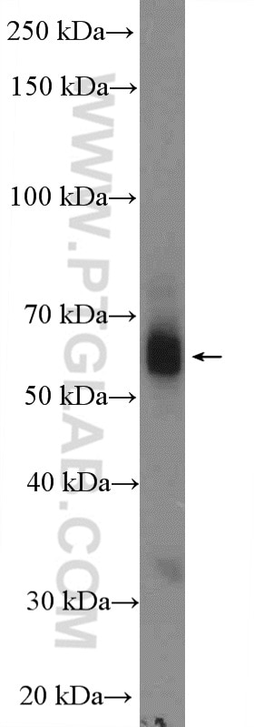 Western Blot (WB) analysis of human placenta tissue using TBXA2R Polyclonal antibody (27159-1-AP)