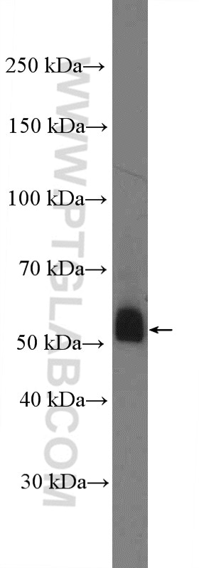 Western Blot (WB) analysis of DU 145 cells using TBXA2R Polyclonal antibody (27159-1-AP)