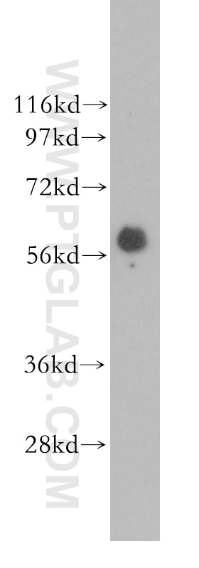 Western Blot (WB) analysis of human colon tissue using TBXAS1 Polyclonal antibody (11321-1-AP)