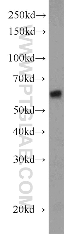 Western Blot (WB) analysis of A549 cells using TBXAS1 Polyclonal antibody (11321-1-AP)