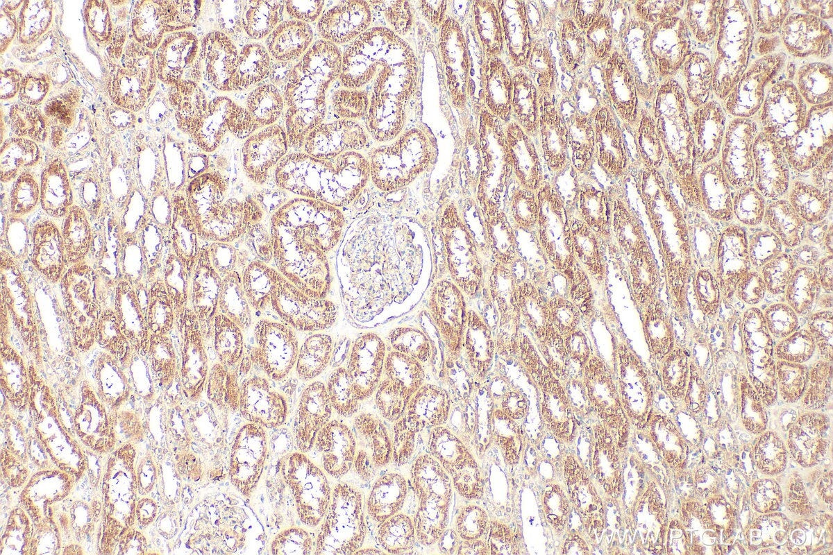 Immunohistochemistry (IHC) staining of human kidney tissue using TBXAS1 Polyclonal antibody (30215-1-AP)
