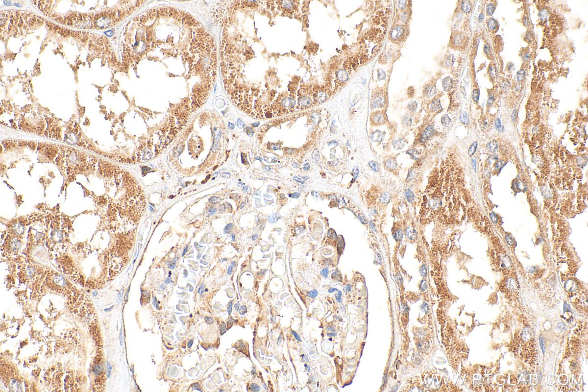 Immunohistochemistry (IHC) staining of human kidney tissue using TBXAS1 Polyclonal antibody (30215-1-AP)