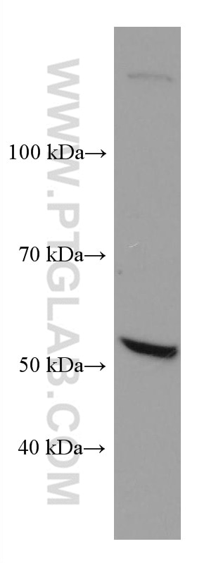 Western Blot (WB) analysis of A549 cells using TBXAS1 Monoclonal antibody (67371-1-Ig)