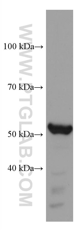 Western Blot (WB) analysis of human peripheral blood platelets using TBXAS1 Monoclonal antibody (67371-1-Ig)