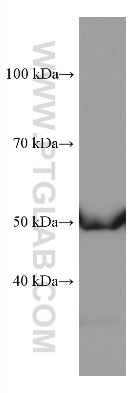 Western Blot (WB) analysis of human placenta tissue using TBXAS1 Monoclonal antibody (67371-1-Ig)