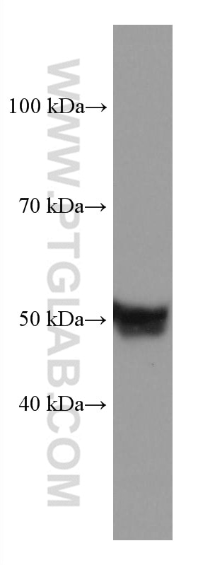 Western Blot (WB) analysis of pig blood using TBXAS1 Monoclonal antibody (67371-1-Ig)