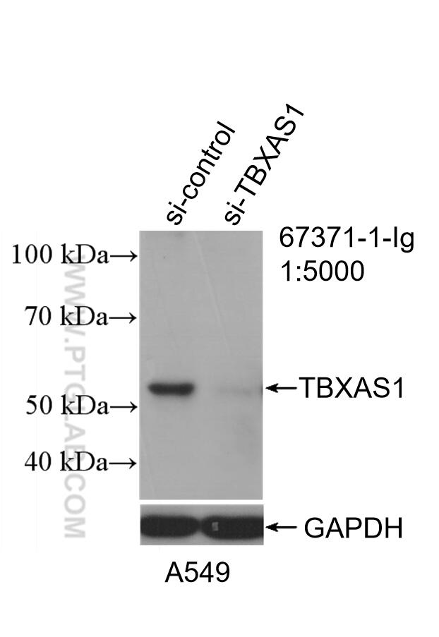 Western Blot (WB) analysis of A549 cells using TBXAS1 Monoclonal antibody (67371-1-Ig)