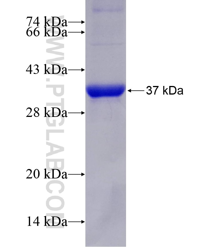 TBXAS1 fusion protein Ag29177 SDS-PAGE