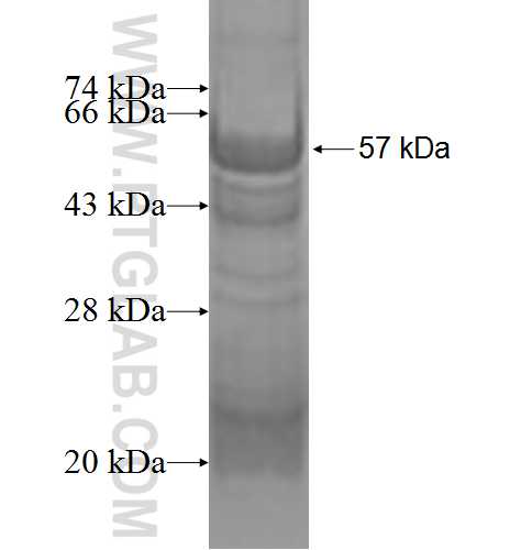 TBXAS1 fusion protein Ag1807 SDS-PAGE