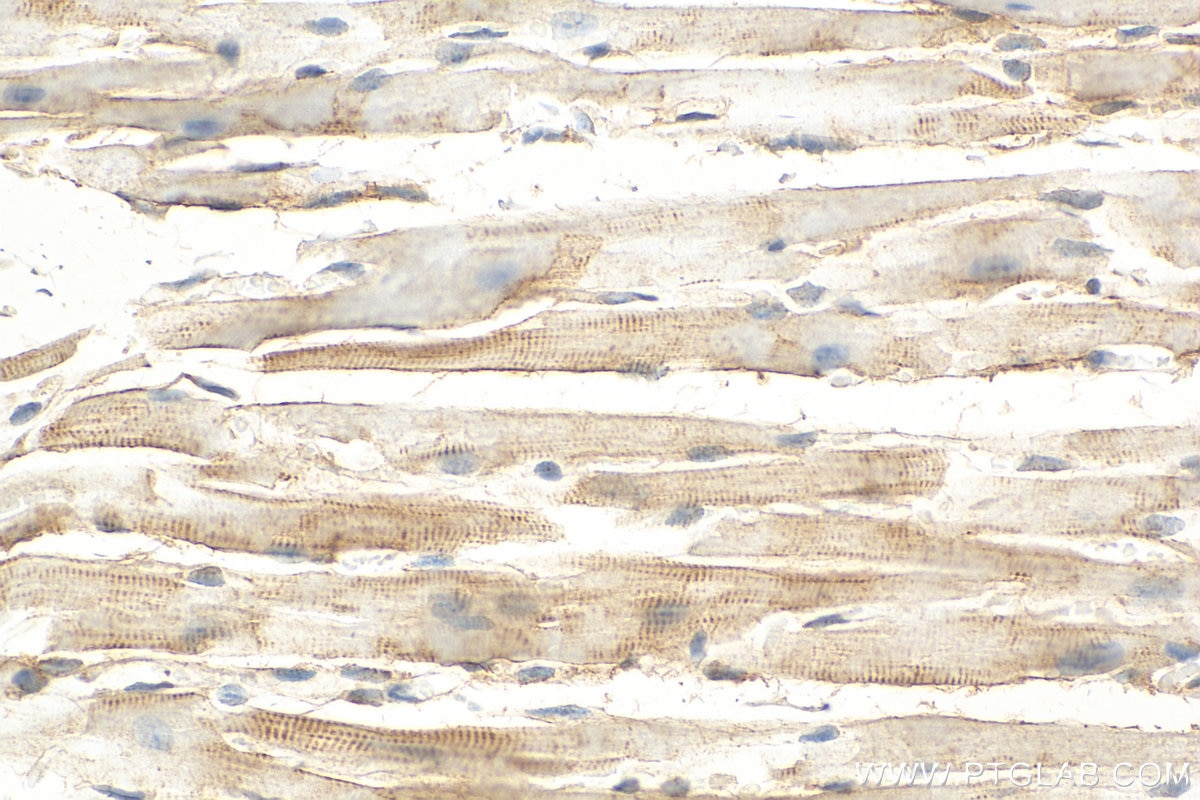 Immunohistochemistry (IHC) staining of mouse heart tissue using Telethonin Polyclonal antibody (16104-1-AP)