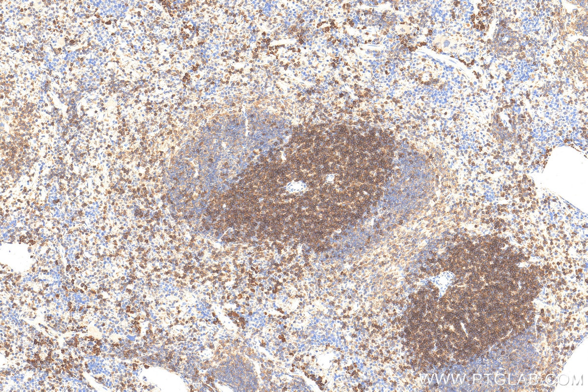Immunohistochemistry (IHC) staining of mouse spleen tissue using TCB1 Polyclonal antibody (32193-1-AP)
