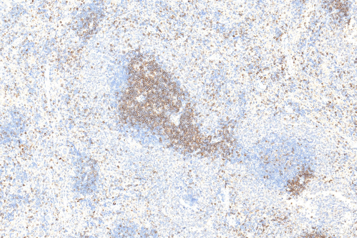 Immunohistochemistry (IHC) staining of rat spleen tissue using TCB1 Polyclonal antibody (32193-1-AP)
