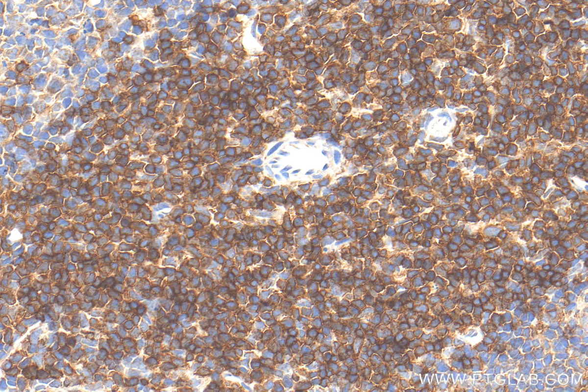 Immunohistochemistry (IHC) staining of mouse spleen tissue using TCB1 Polyclonal antibody (32193-1-AP)