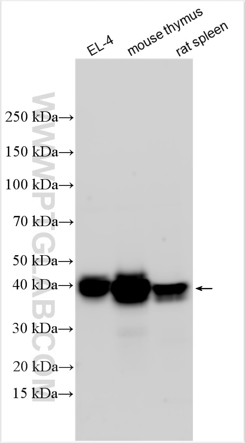 Western Blot (WB) analysis of various lysates using TCB1 Polyclonal antibody (32193-1-AP)