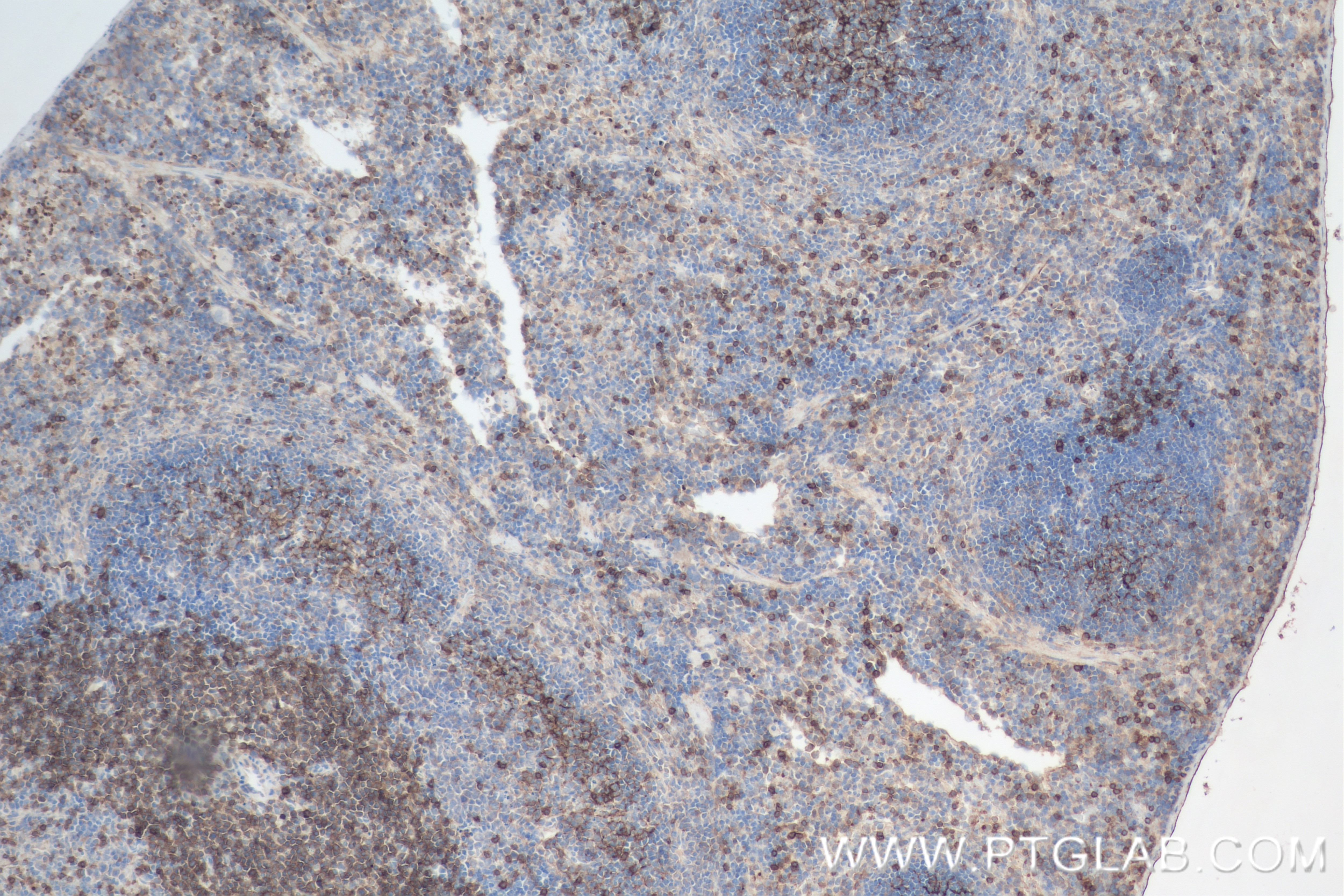 Immunohistochemistry (IHC) staining of mouse spleen tissue using TCB1 Recombinant antibody (84878-5-RR)