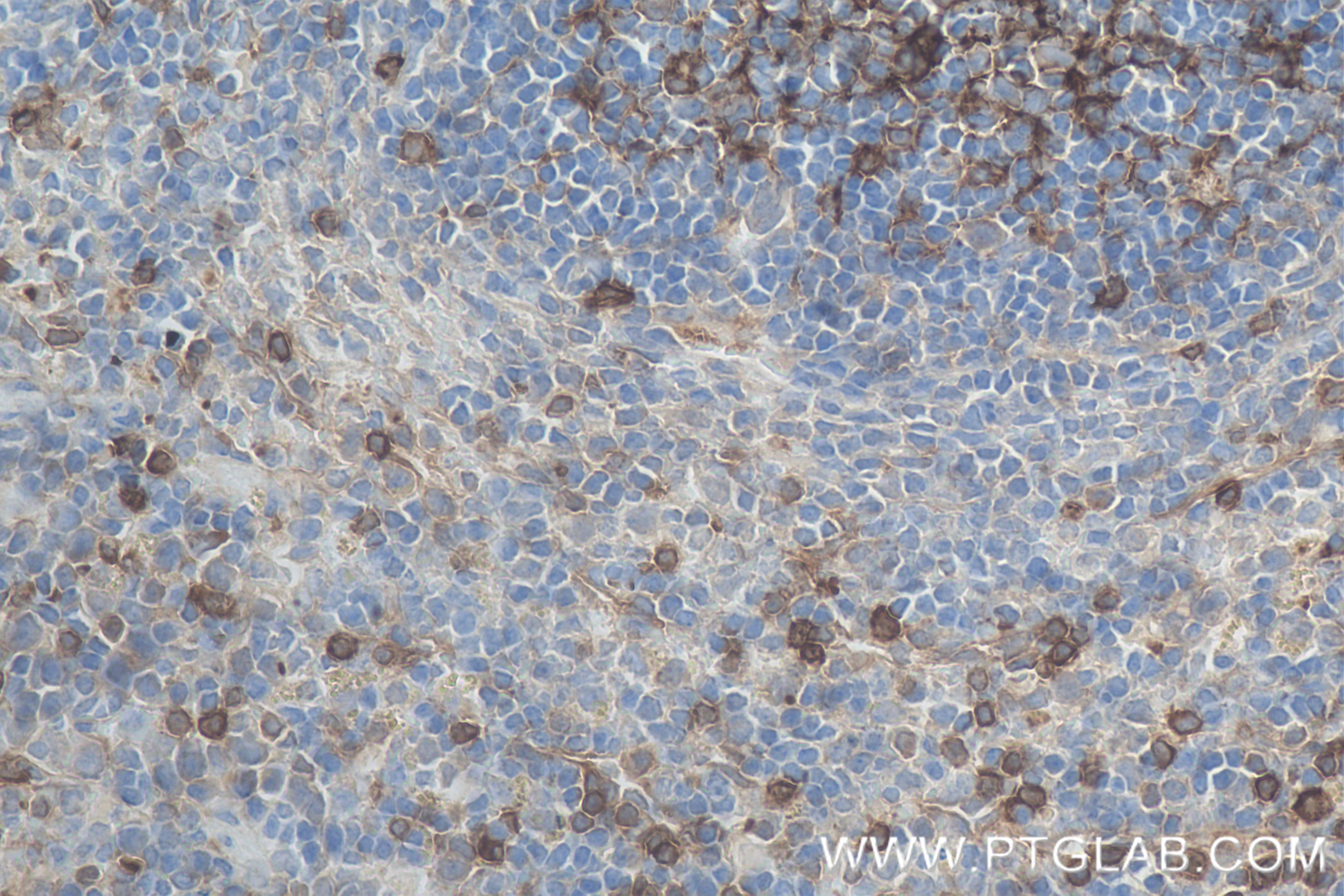 Immunohistochemistry (IHC) staining of mouse spleen tissue using TCB1 Recombinant antibody (84878-5-RR)