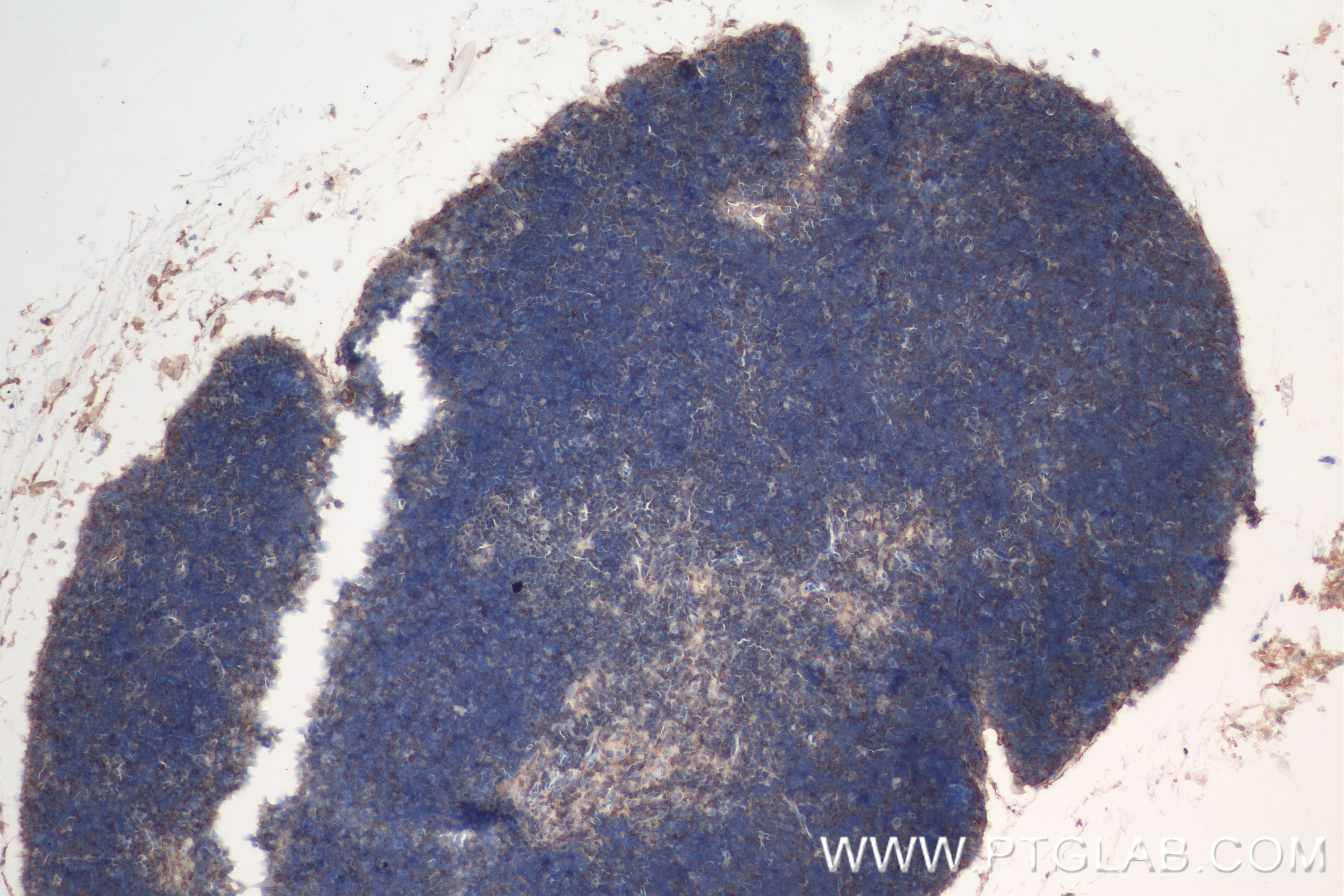 Immunohistochemistry (IHC) staining of mouse thymus tissue using TCB1 Recombinant antibody (84878-5-RR)