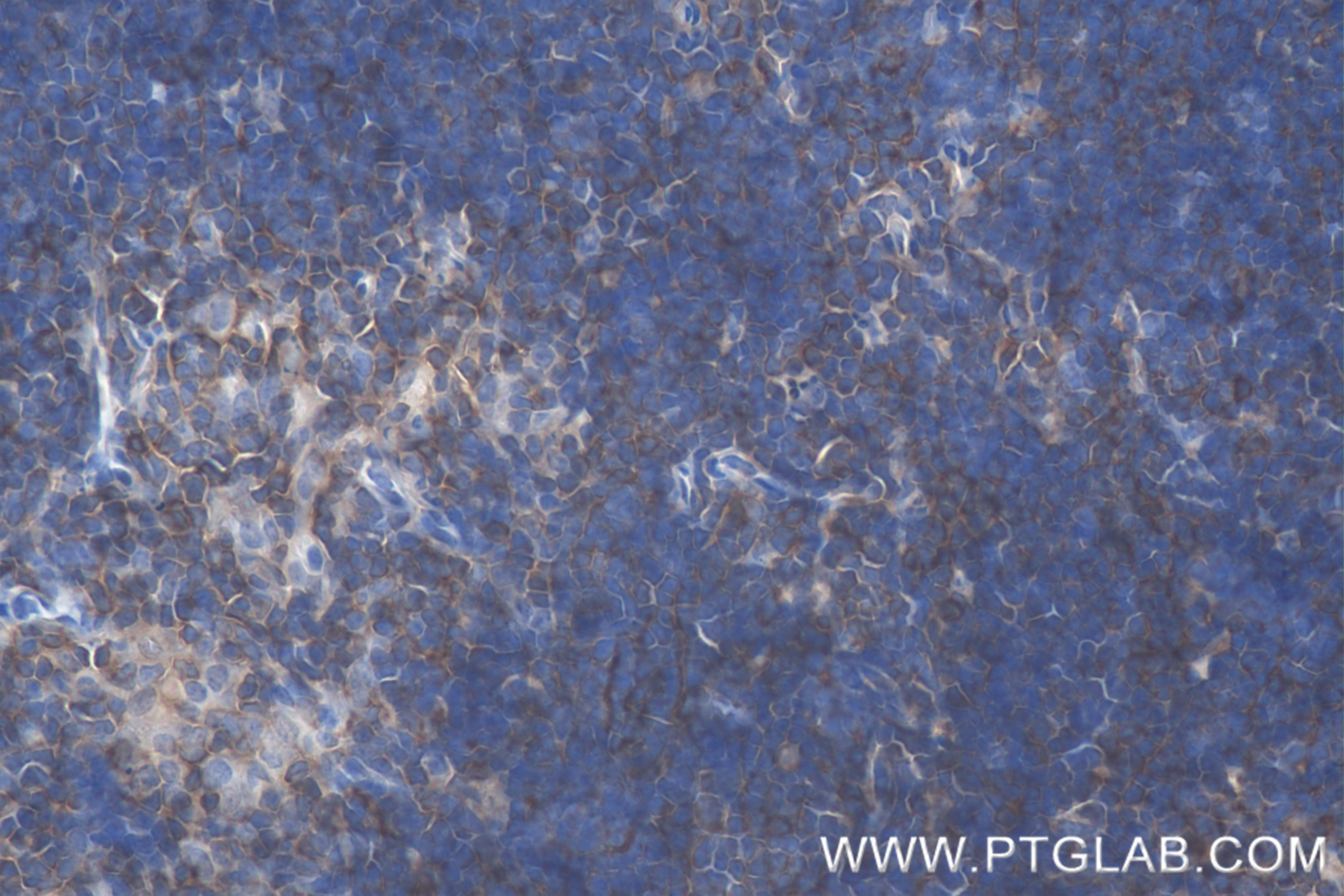 Immunohistochemistry (IHC) staining of mouse thymus tissue using TCB1 Recombinant antibody (84878-5-RR)