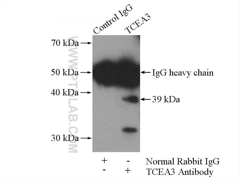 Immunoprecipitation (IP) experiment of HeLa cells using TCEA3 Polyclonal antibody (17158-1-AP)