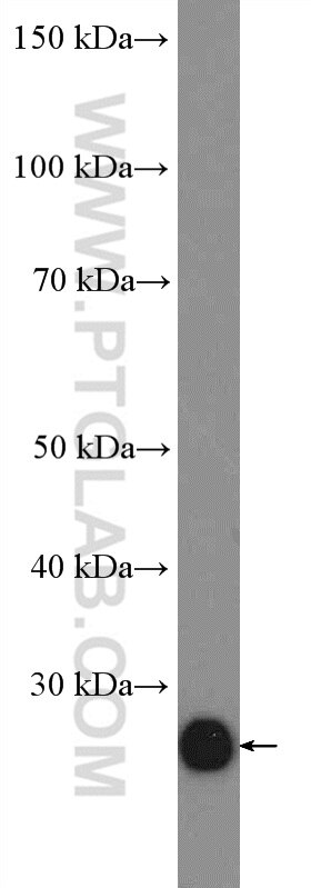 Western Blot (WB) analysis of mouse brain tissue using TCEAL1 Polyclonal antibody (11993-1-AP)