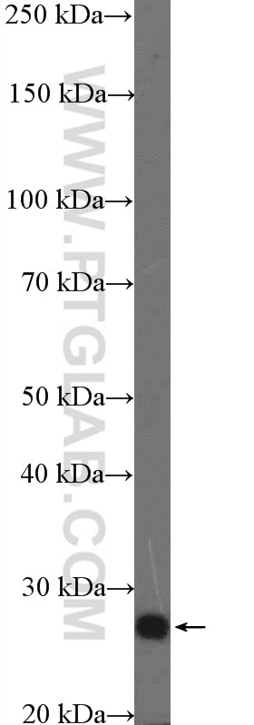 Western Blot (WB) analysis of mouse brain tissue using TCEAL1 Polyclonal antibody (11993-1-AP)